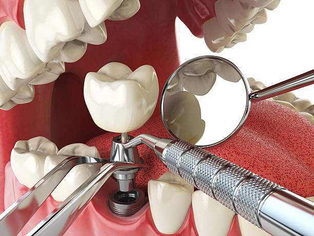 Best Emergency Dental Services for Seniors in Wakefield, NE